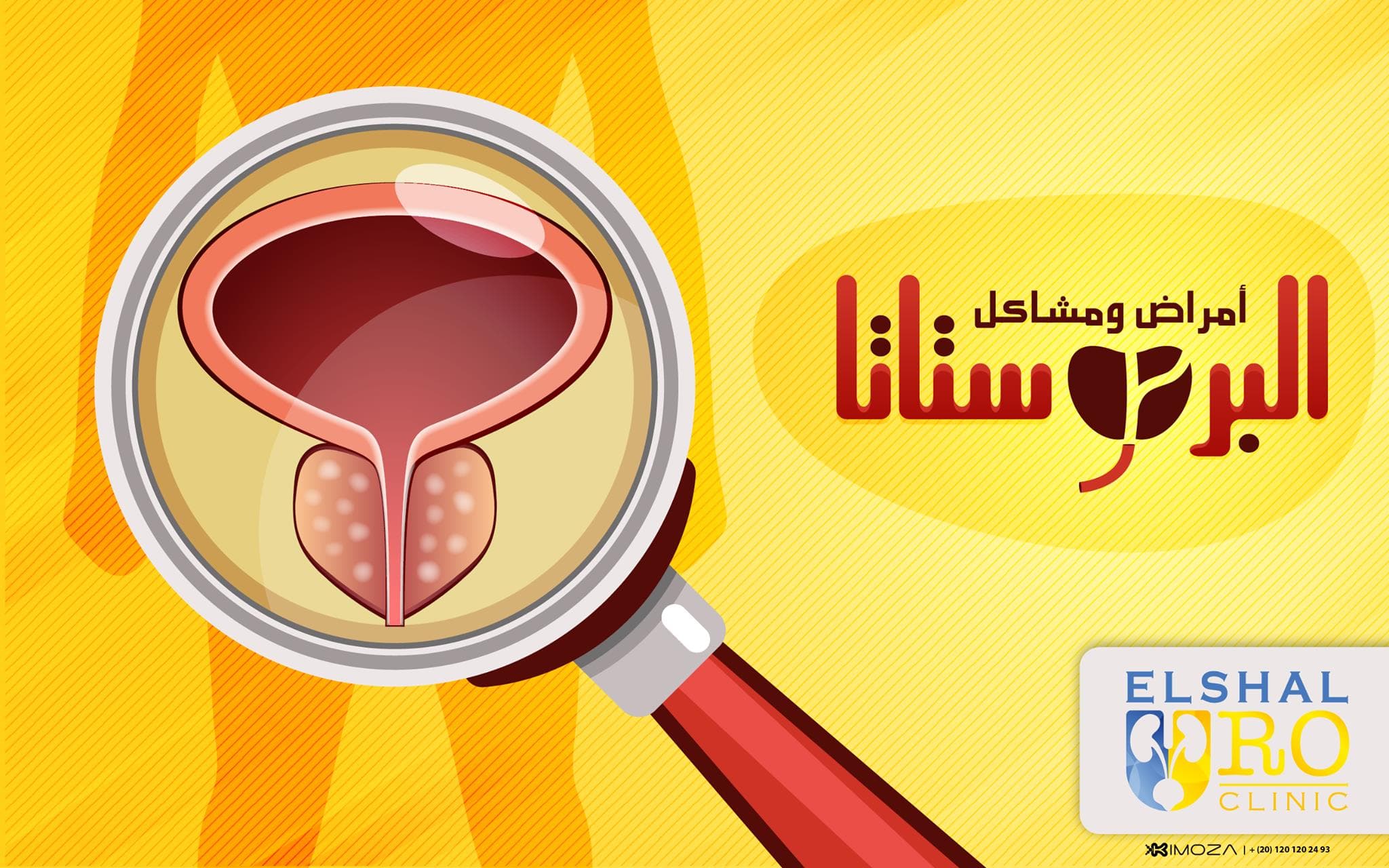 Prostate Diseases and Problems