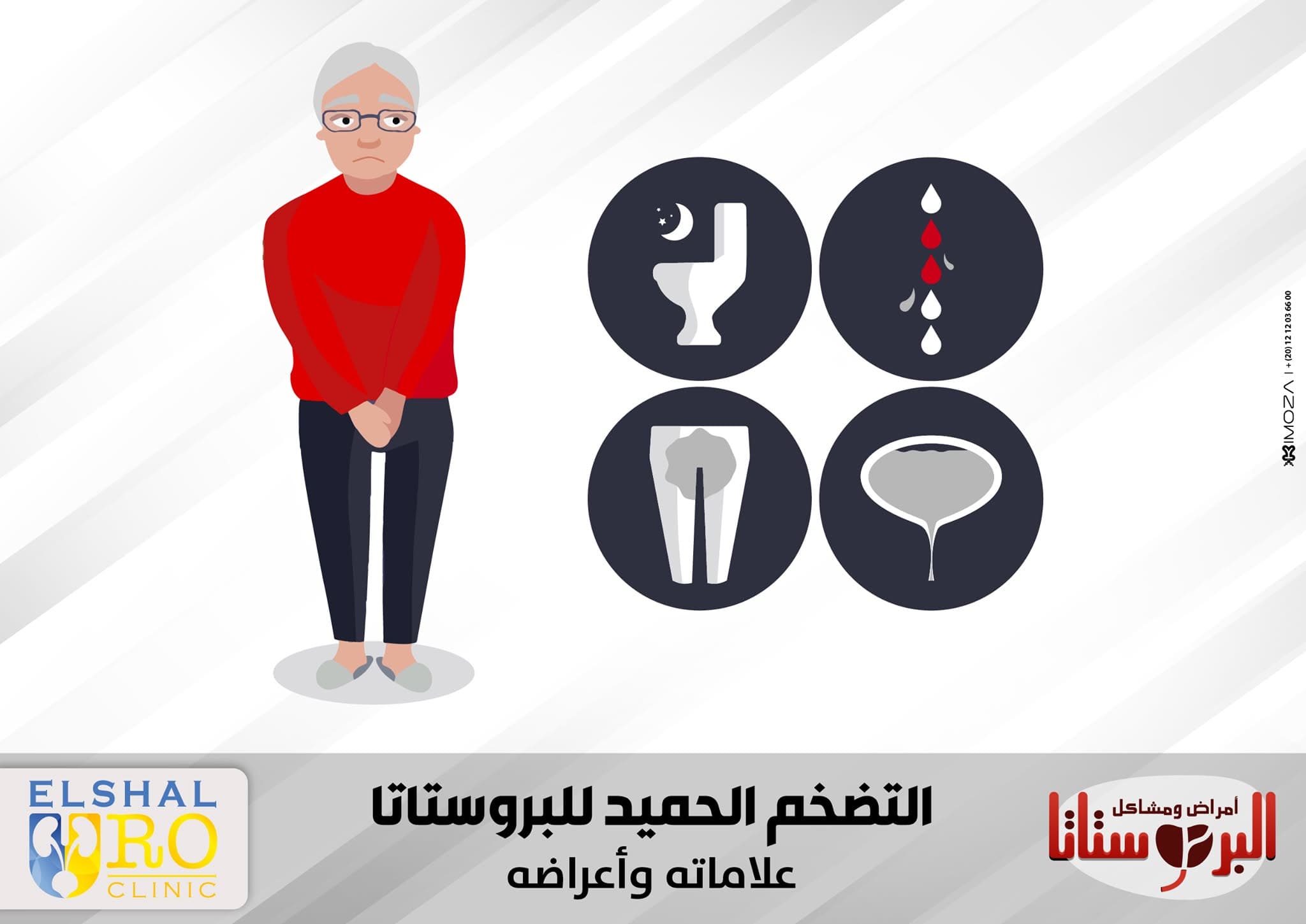 Benign Prostatic Hyperplasia
