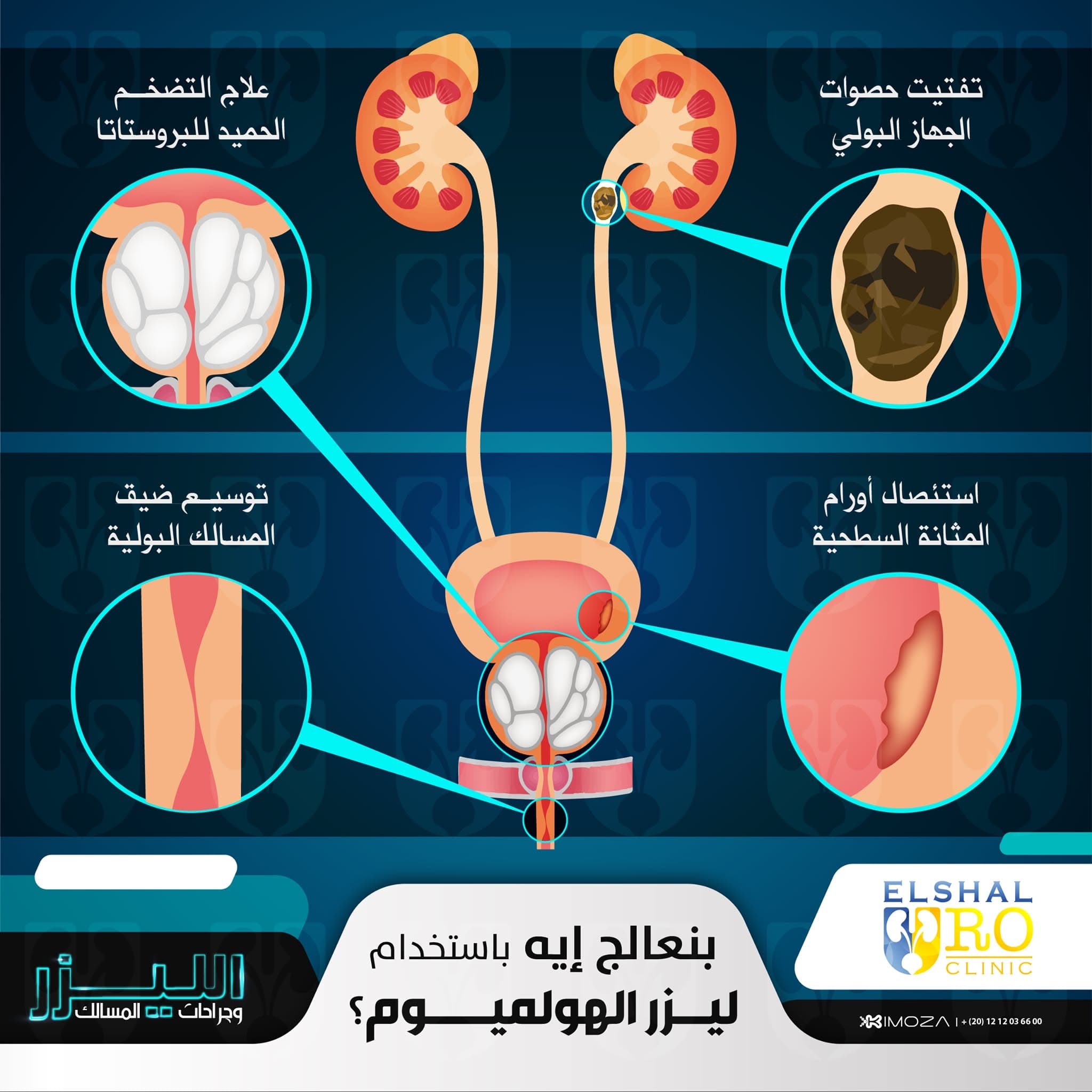 What do we treat using the Ho:YAG Laser?