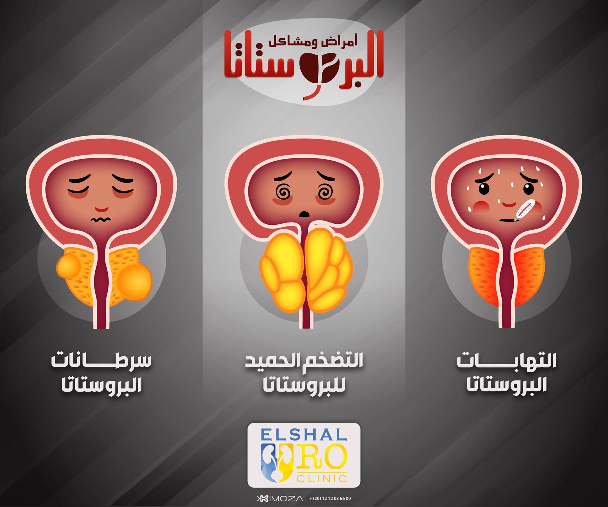 أمراض ومشاكل البروستاتا